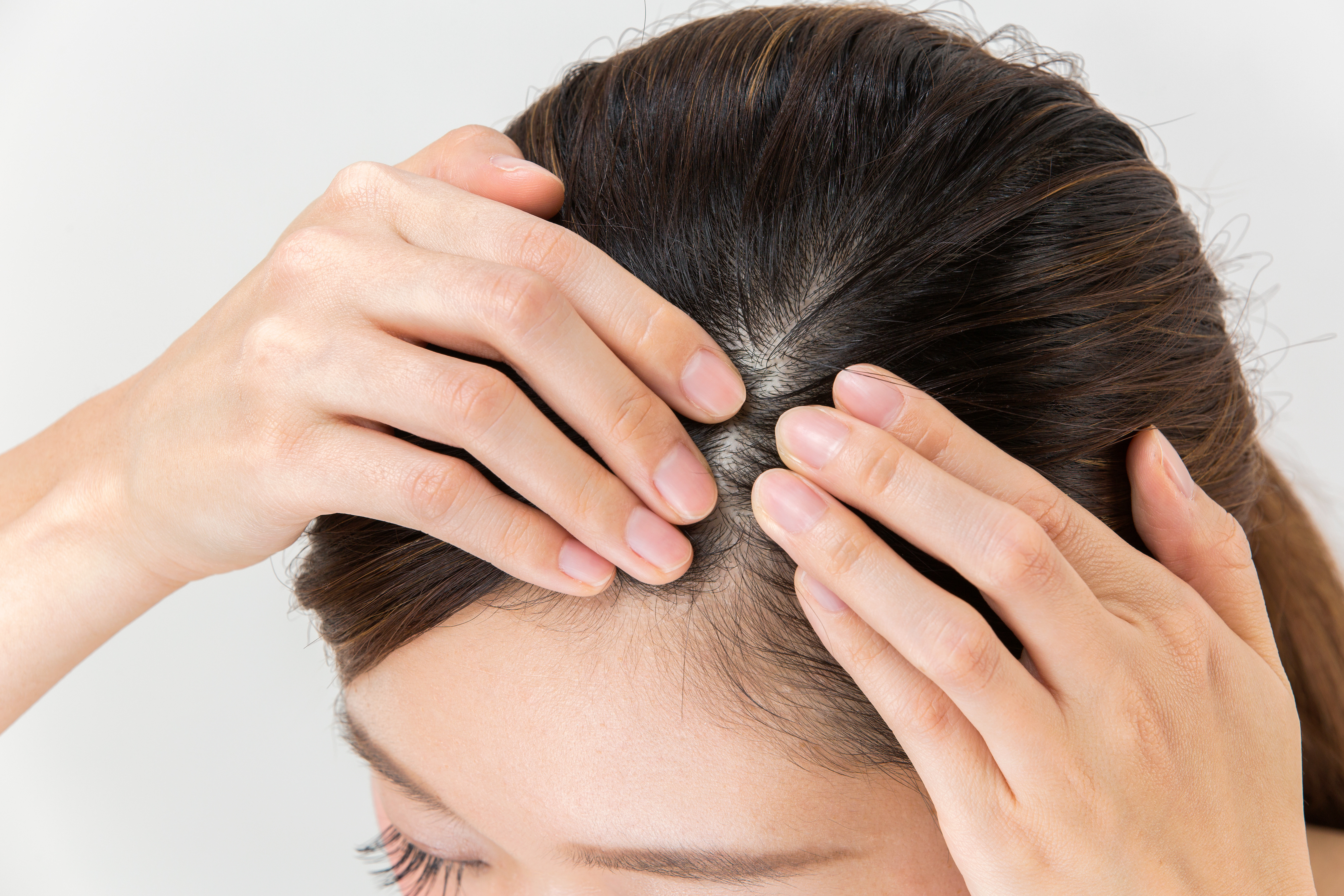 Выпадение волос (алопеция) - причины, симптомы, лечение, диагностика,  патогенез