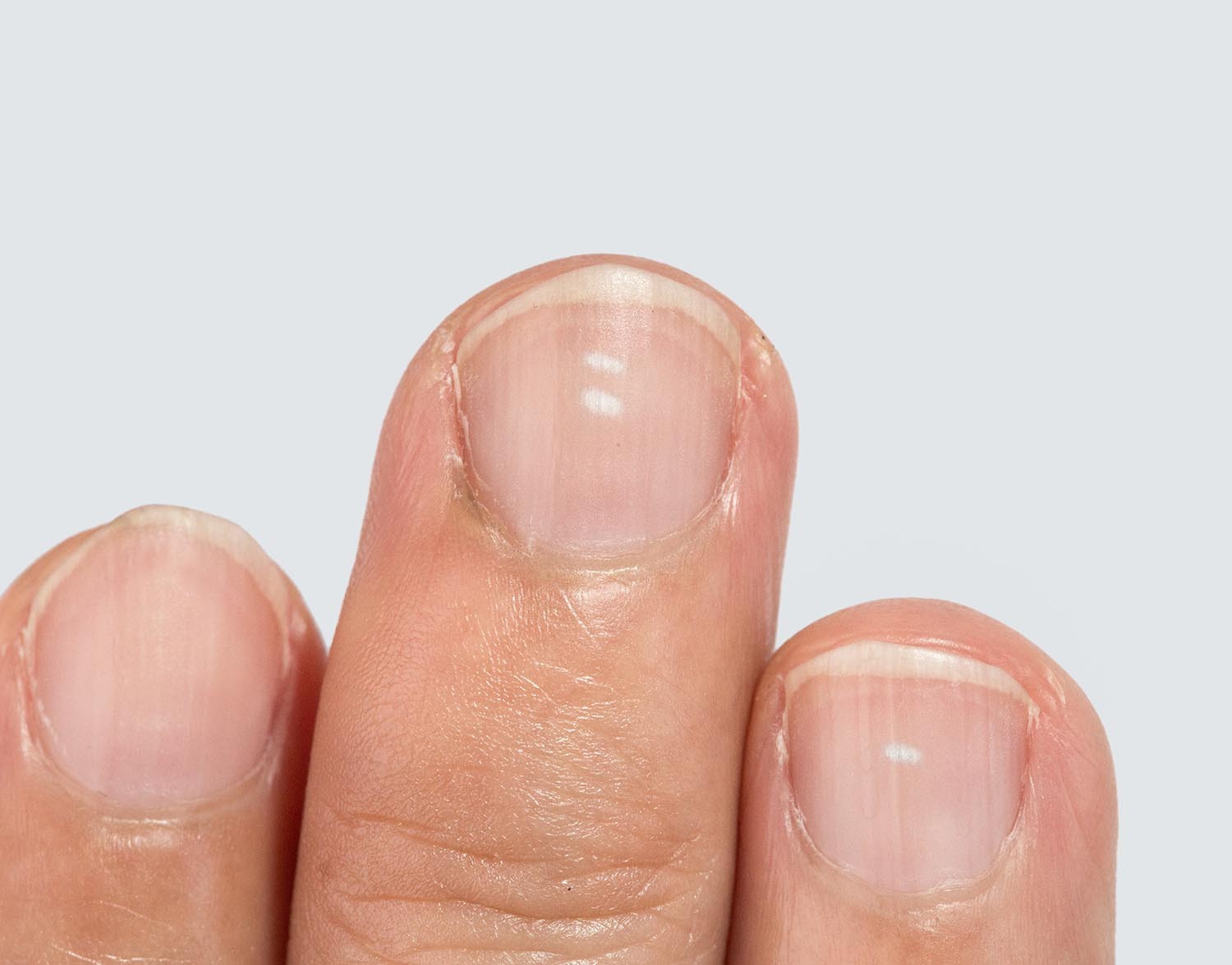 Микроэлементы: секрет крепких ногтей